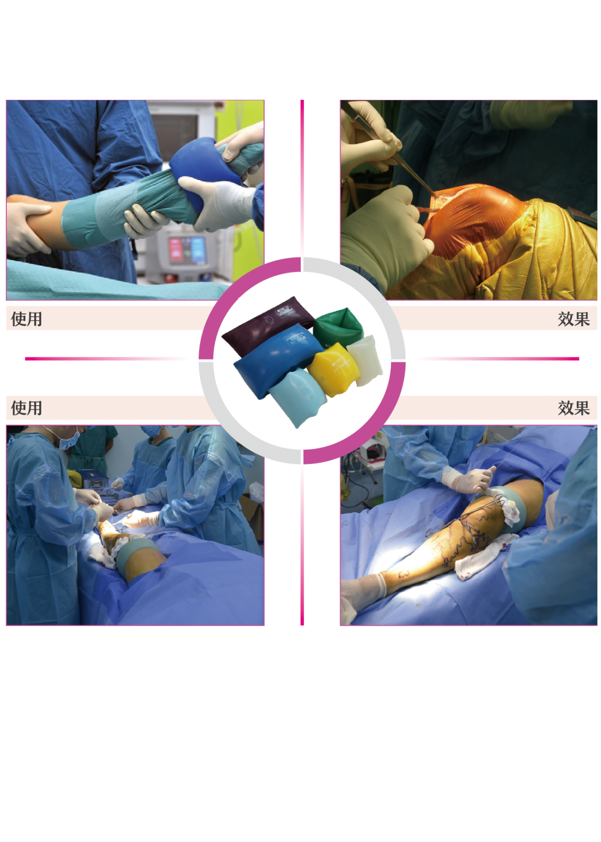 驅(qū)血器（肢體壓力套）：主要針對手術(shù)室的產(chǎn)品。