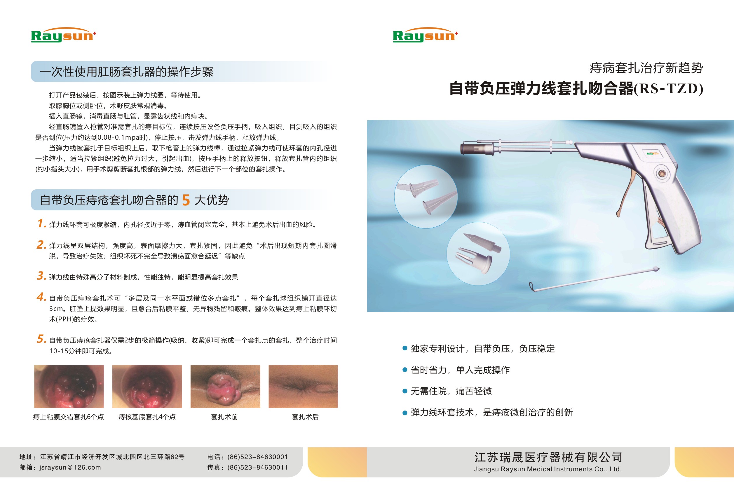 自帶負(fù)壓彈力線(xiàn)套扎吻合器